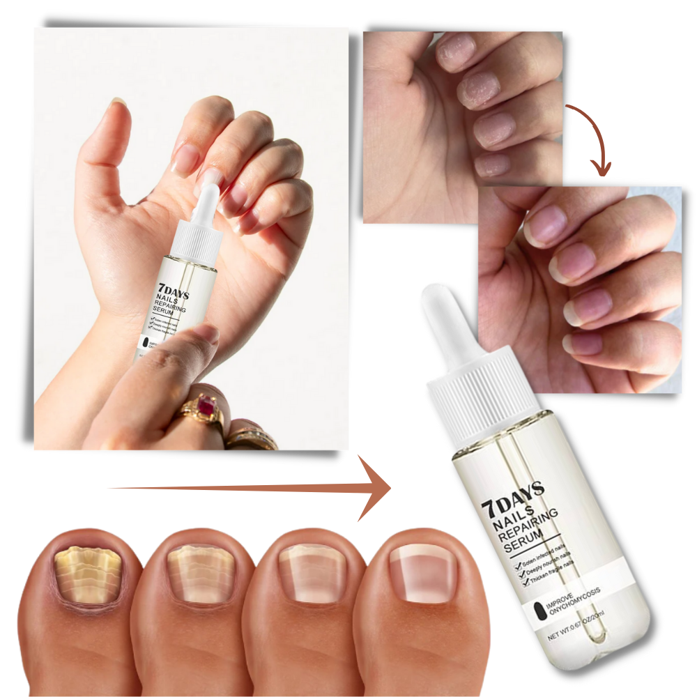 Nail Repair Serum with Brush Applicator and Glycerin, 20ml Bottle