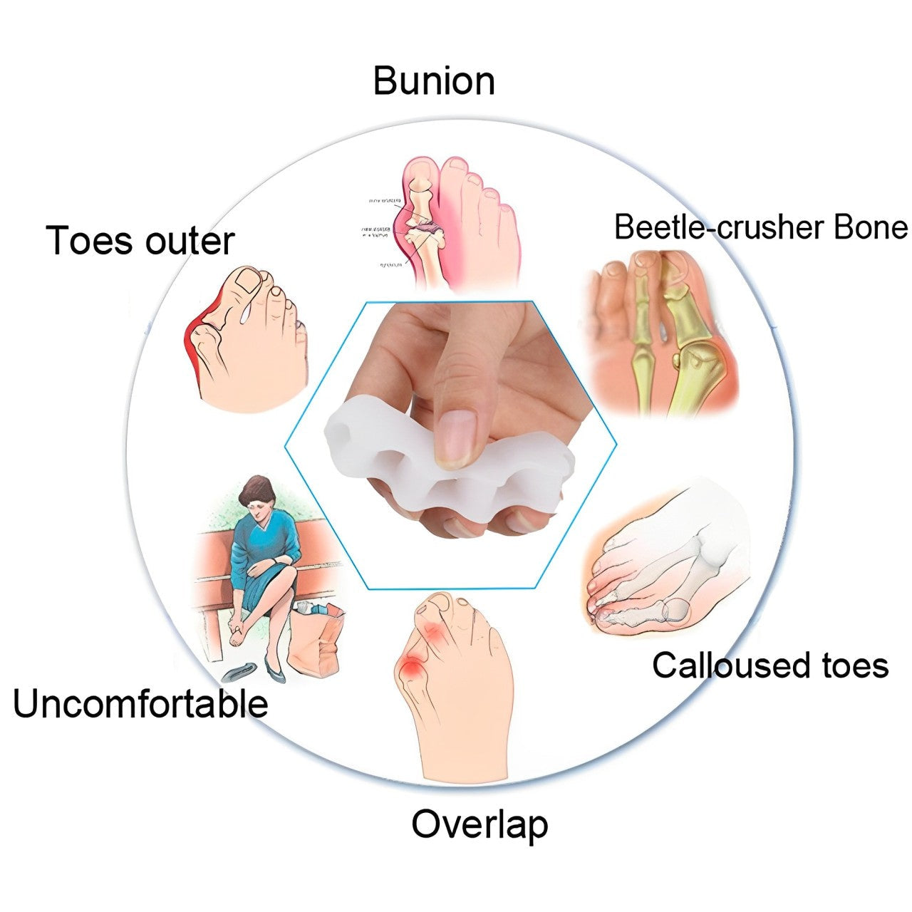Orthopedic Hammer Toe Splint Brace for Correct Toe Alignment