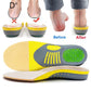 Gel Insoles with Arch Support and Heel Cup for Flat Feet, Pair