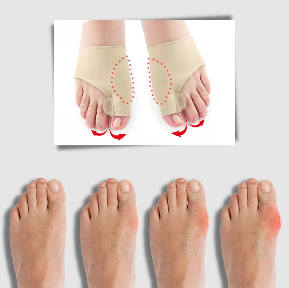 Gel Bunion Corrector with Toe Separator and Side Cushion Pad