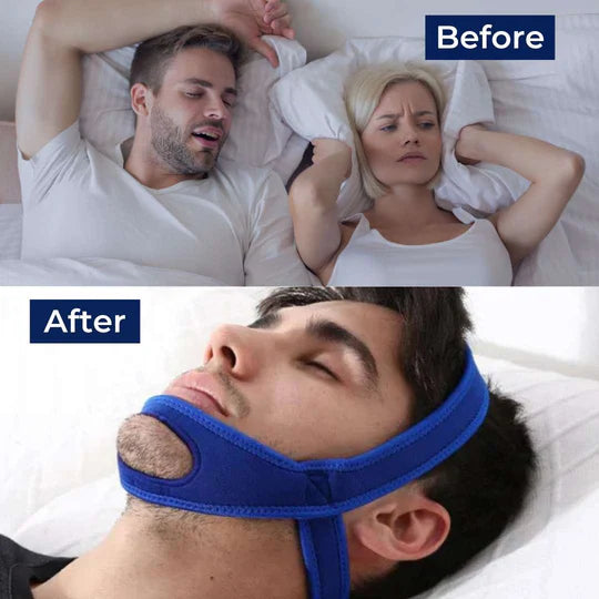 Adjustable Full Head Chin Strap for Snoring Relief and Sleep Apnea Support