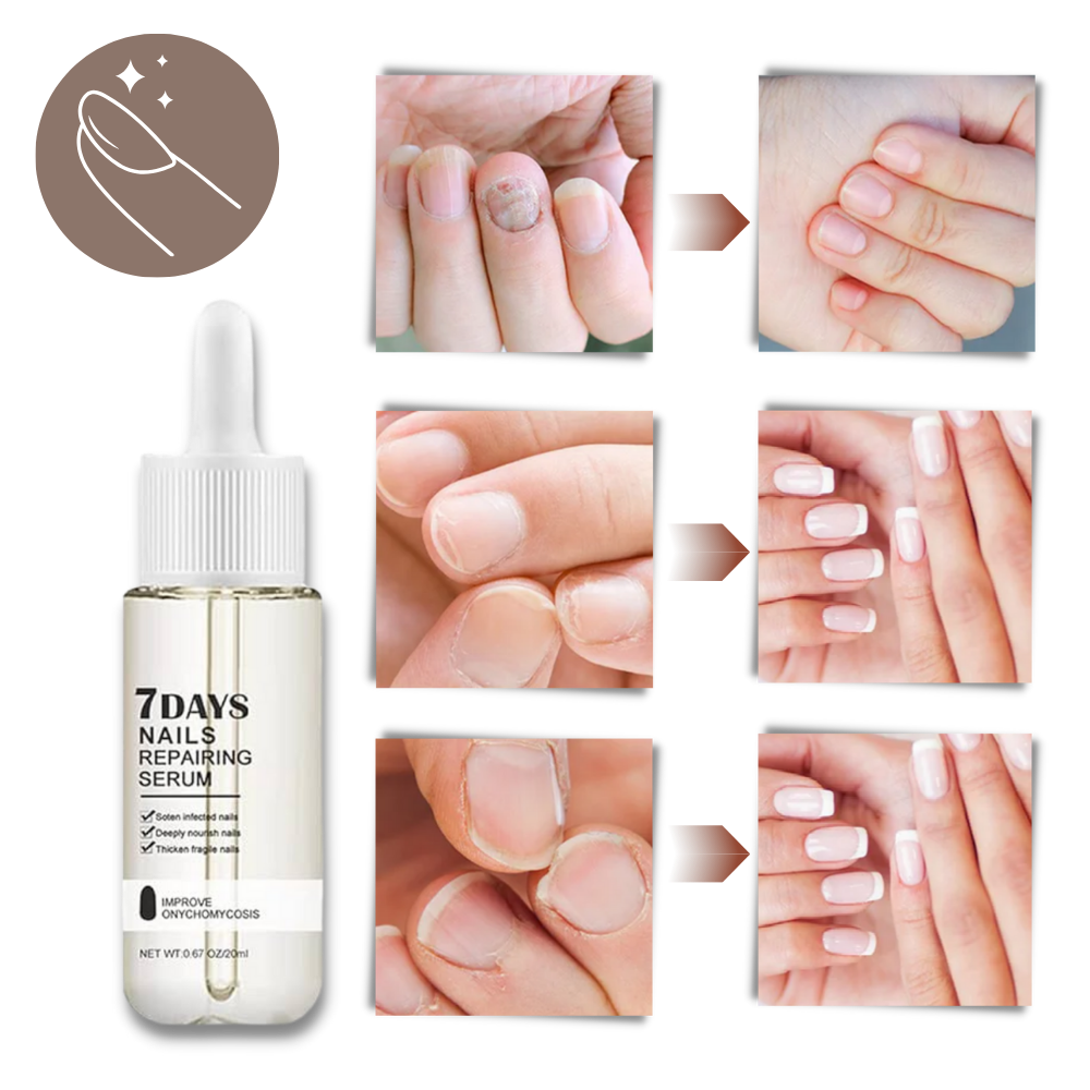 Nail Repair Serum with Brush Applicator and Glycerin, 20ml Bottle