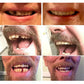 Sjbackyard Temporary False Teeth Cosmetic Dental Veneers