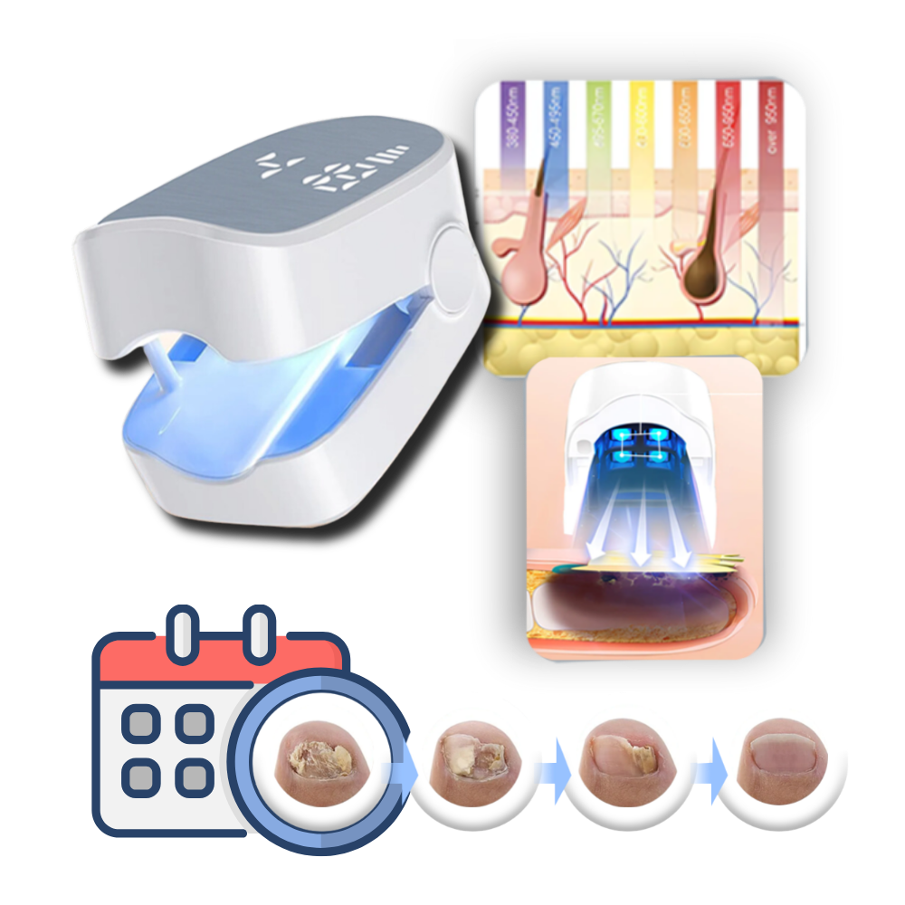 Dual Laser Nail Treatment Device with Cold Laser and Blue Light Technology