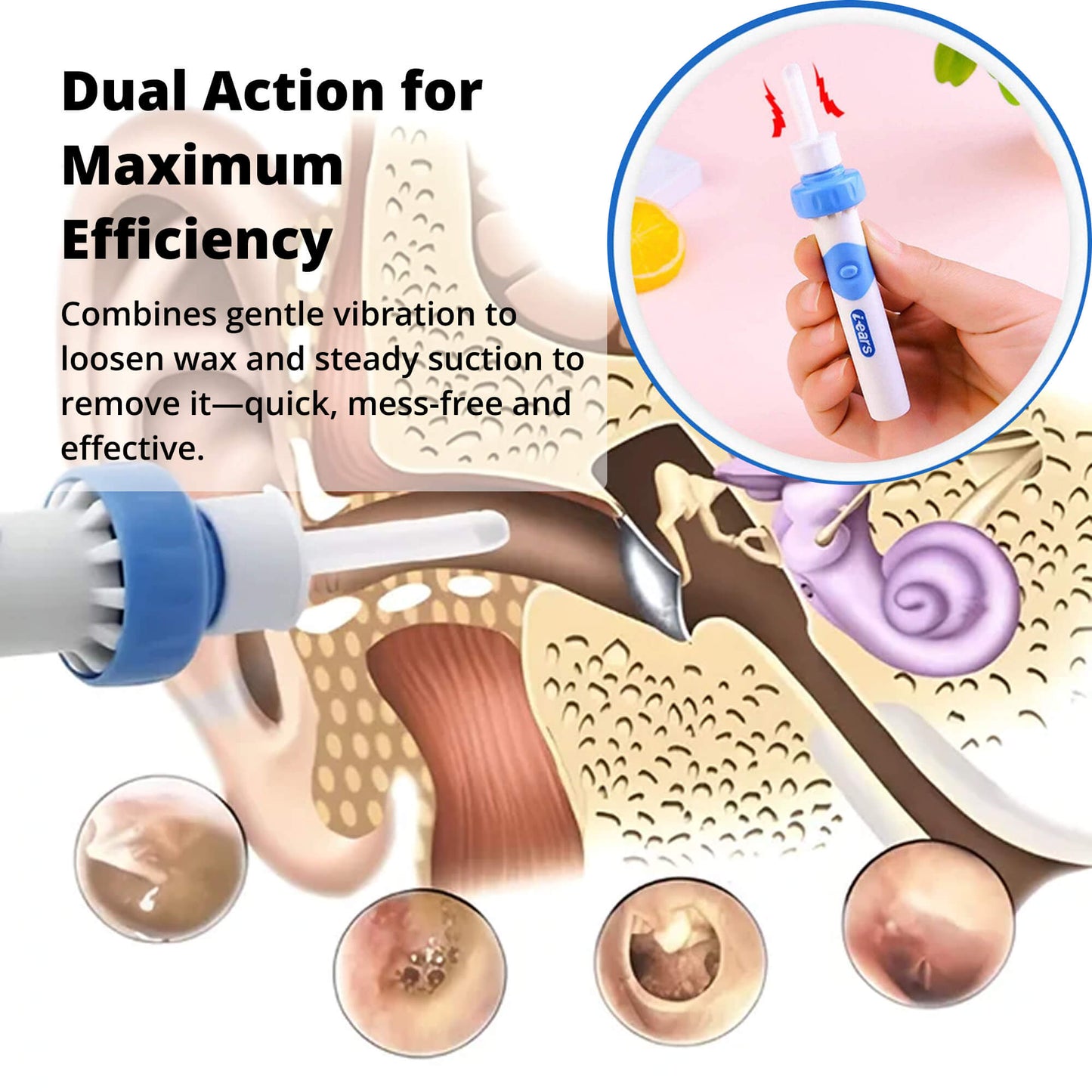 Electric Ear Wax Suction Tool with Medical Grade Silicone Tip and 60-Minute Battery