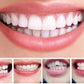Teeth Alignment Tray with Three Progressive Levels and Universal Mold Design