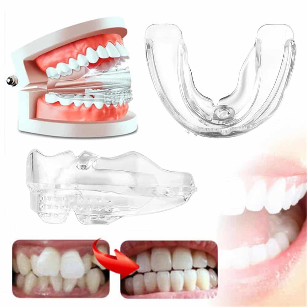 Teeth Alignment Tray with Three Progressive Levels and Universal Mold Design