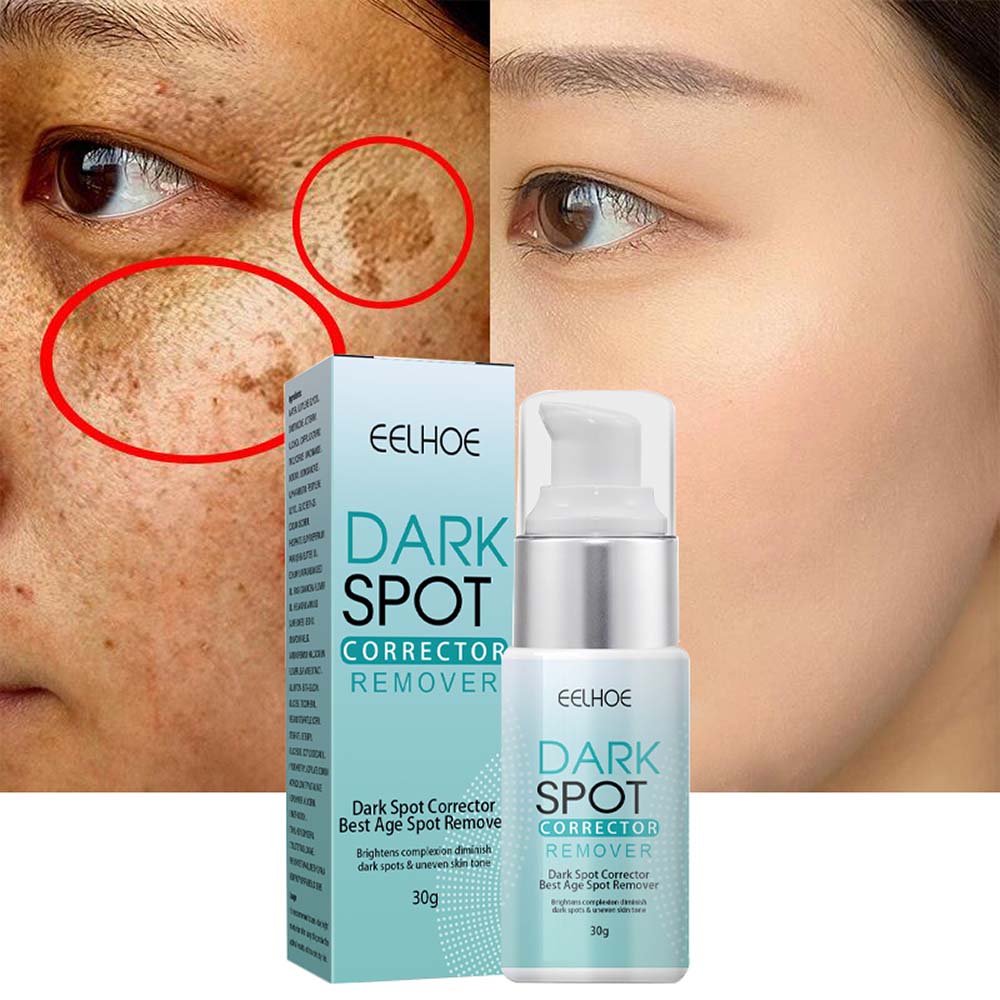 Nicotinamide Cream for Dark Spots and Even Skin Tone with Hydrating Formula