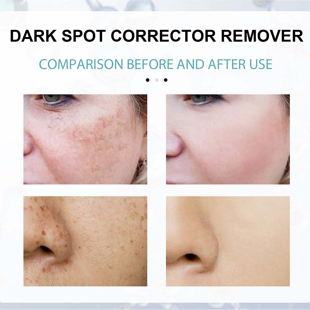 Nicotinamide Cream for Dark Spots and Even Skin Tone with Hydrating Formula