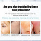 Nicotinamide Cream for Dark Spots and Even Skin Tone with Hydrating Formula