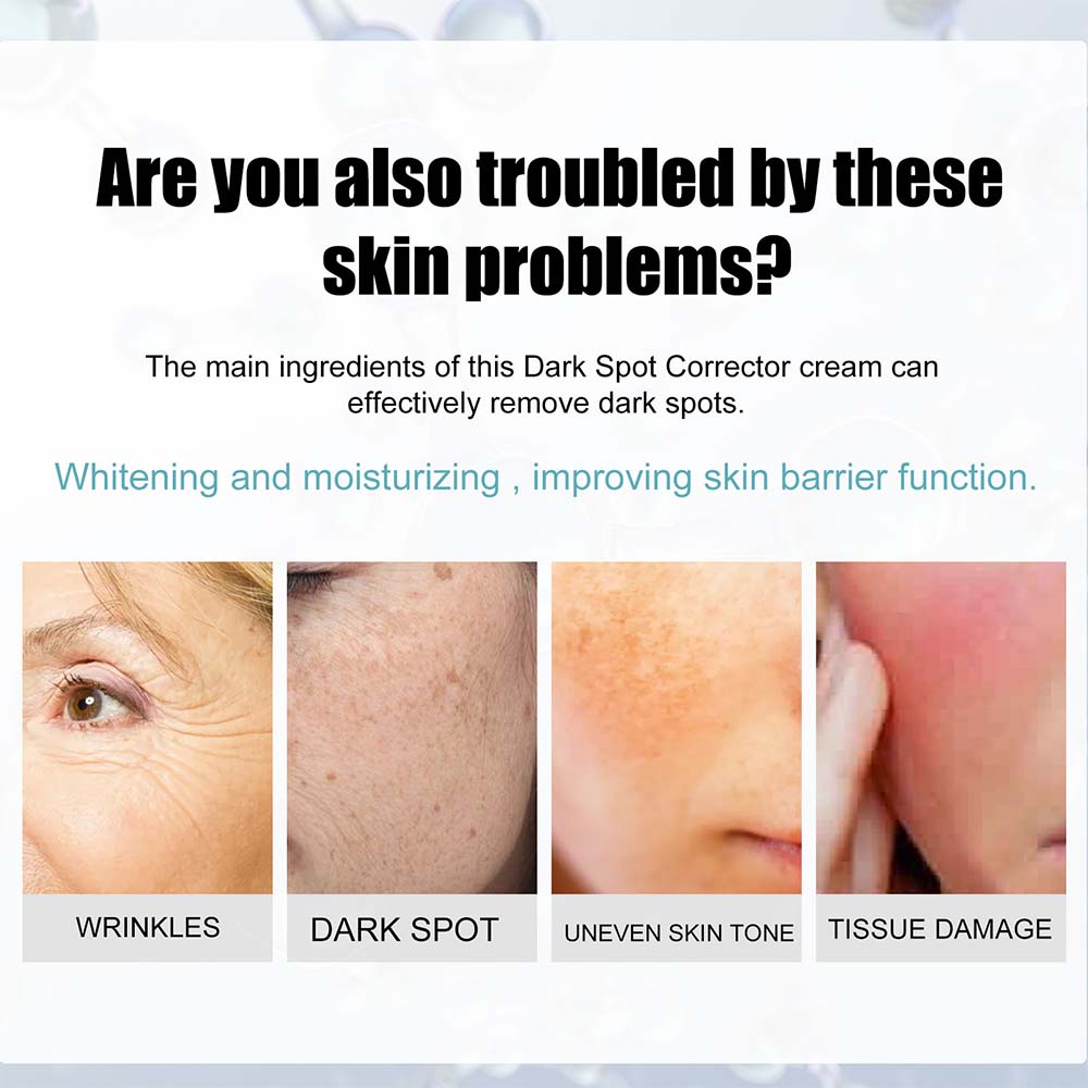 Nicotinamide Cream for Dark Spots and Even Skin Tone with Hydrating Formula