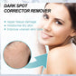 Nicotinamide Cream for Dark Spots and Even Skin Tone with Hydrating Formula