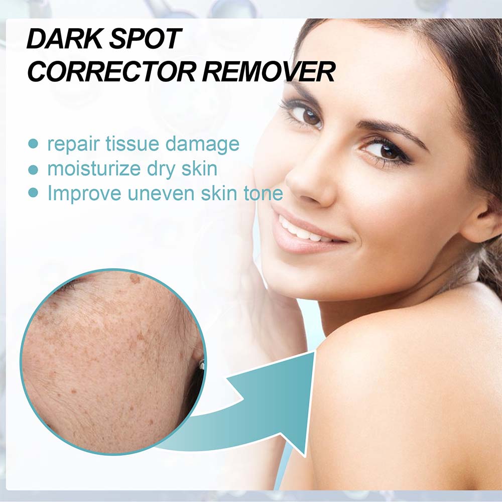 Nicotinamide Cream for Dark Spots and Even Skin Tone with Hydrating Formula