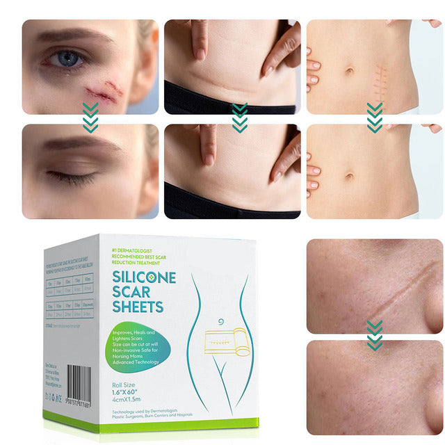 Silicone Scar Removal Sheet with Water Resistant Adhesive and Breathable Design