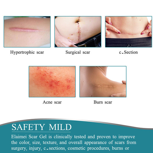 Silicone Scar Removal Sheet with Water Resistant Adhesive and Breathable Design