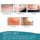 Silicone Scar Removal Sheet with Water Resistant Adhesive and Breathable Design