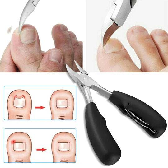 Sjbackyard Nail Clippers for Thick Nails for Seniors