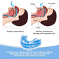 Sjbackyard Adjustable Mandibular Advancement Device for Snoring Reduction