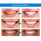 sjbackyard Teeth Whitening Essence Pen