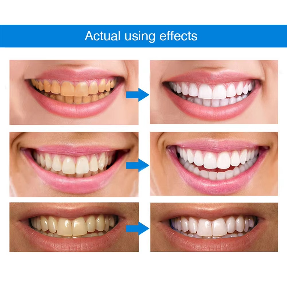 sjbackyard Teeth Whitening Essence Pen
