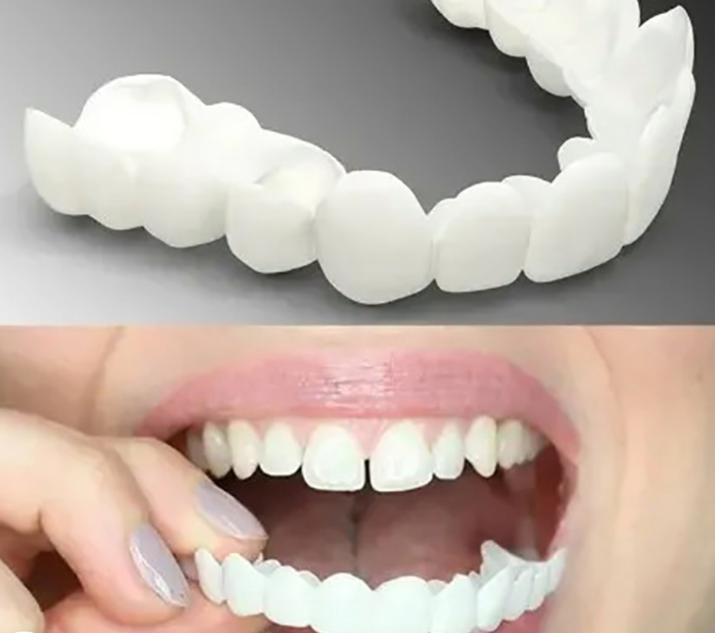 Snap-On Dentures with Flexible Polypropylene and Natural Tooth Coloring