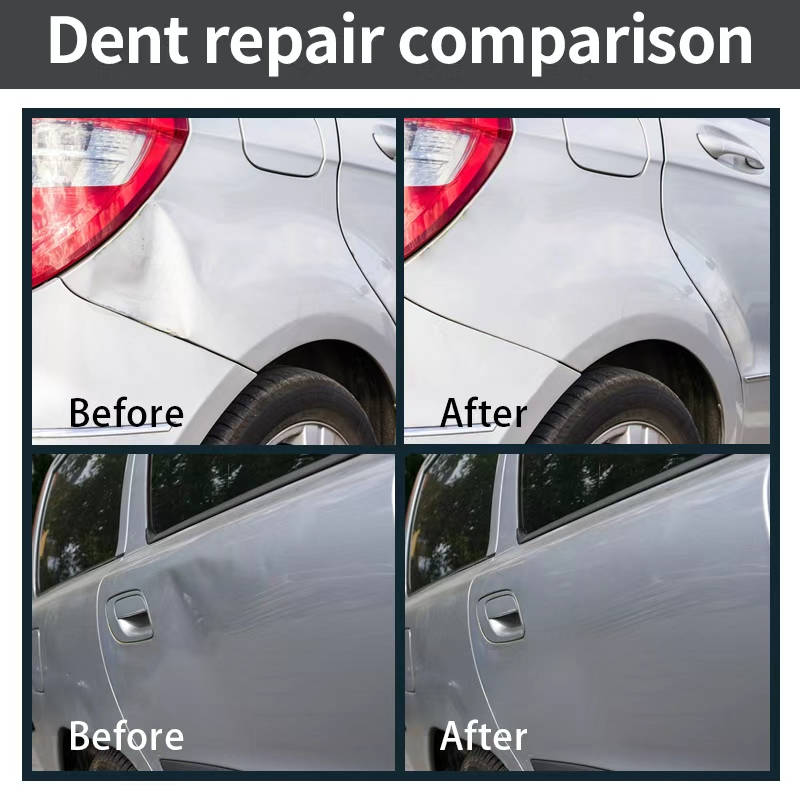 Easy DIY Car Dent Removal Tool Kit, Paintless Auto Body Repair Tools