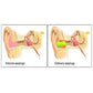 Ear Plugs for Snoring, Noise-Reducing Silicone Earplugs for Peaceful Sleep