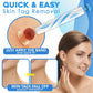 Loop-Based Application Tool for Manual Skin Tag Removal