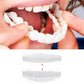 Removable Upper and Lower Cosmetic Smile Cover System
