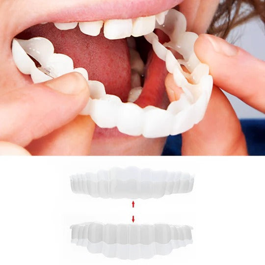 Removable Upper and Lower Cosmetic Smile Cover System