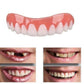 Artificial Teeth Cover for Temporary Cosmetic Smile Appearance Enhancement