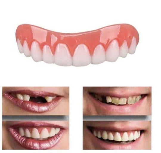 Artificial Teeth Cover for Temporary Cosmetic Smile Appearance Enhancement