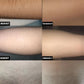 At-Home Laser Hair Removal Device for Full Body Use