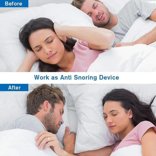 Airing Micro-CPAP Device for Hassle-Free Snoring Reduction