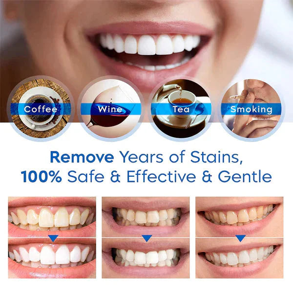 sjbackyard Teeth Whitening Essence Pen