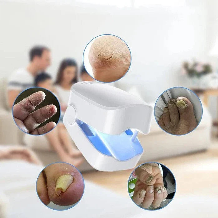 Portable Nail Fungus Laser Device with Rechargeable Battery and One-Button Operation