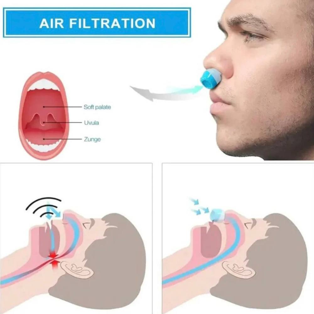 Compact Micro CPAP Device for Sleep Apnea Relief and Snoring Reduction