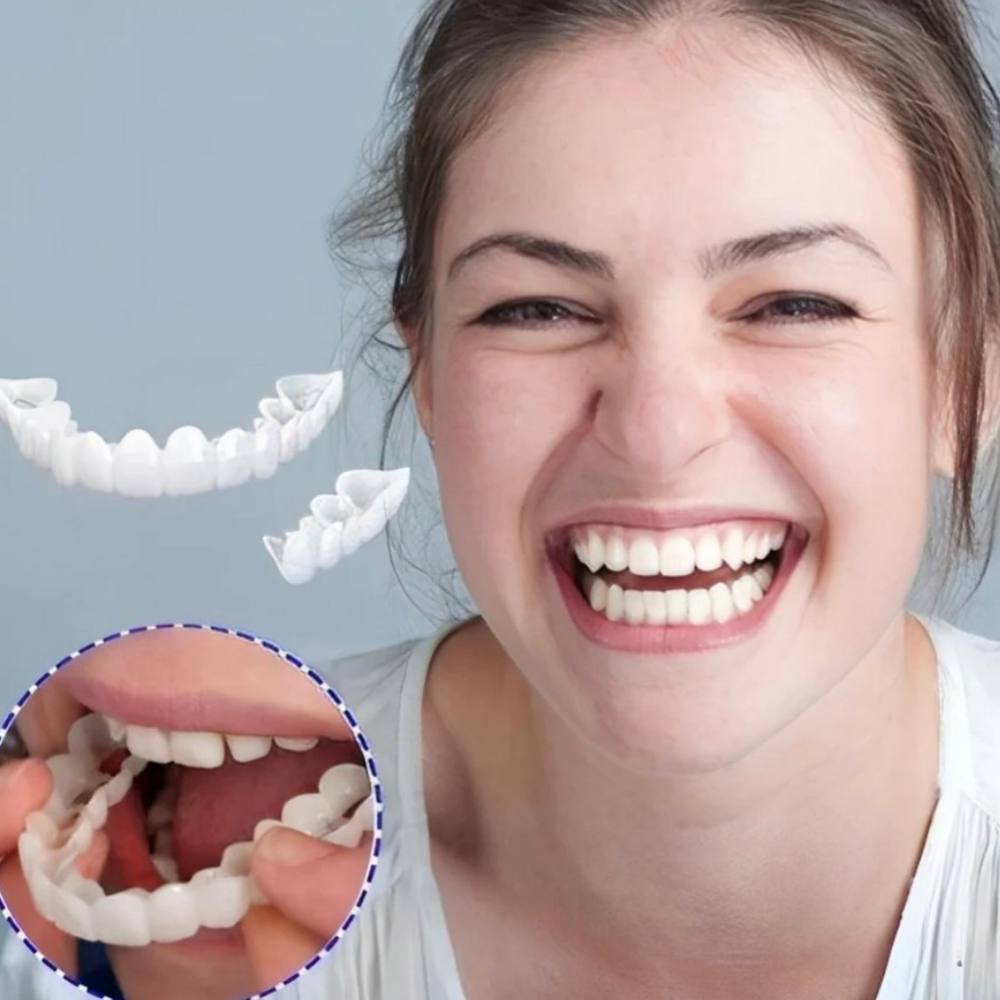 Clip On Smile Veneer for Upper and Lower Teeth