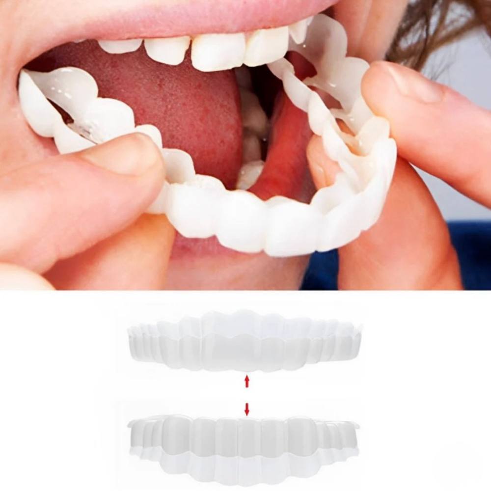 Clip On Smile Veneer for Upper and Lower Teeth